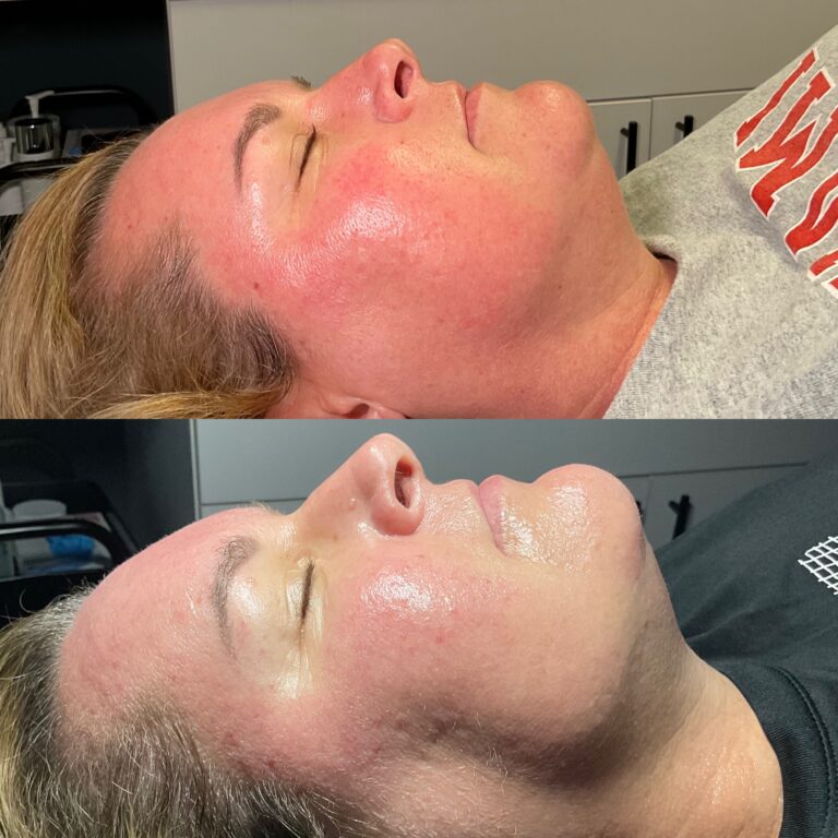 0EE8B833-D07E-4442-B736-31F9D7F0156A