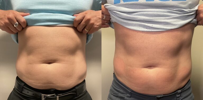 F510C0FE-CDCF-4845-9888-80E5EAD9CCBC