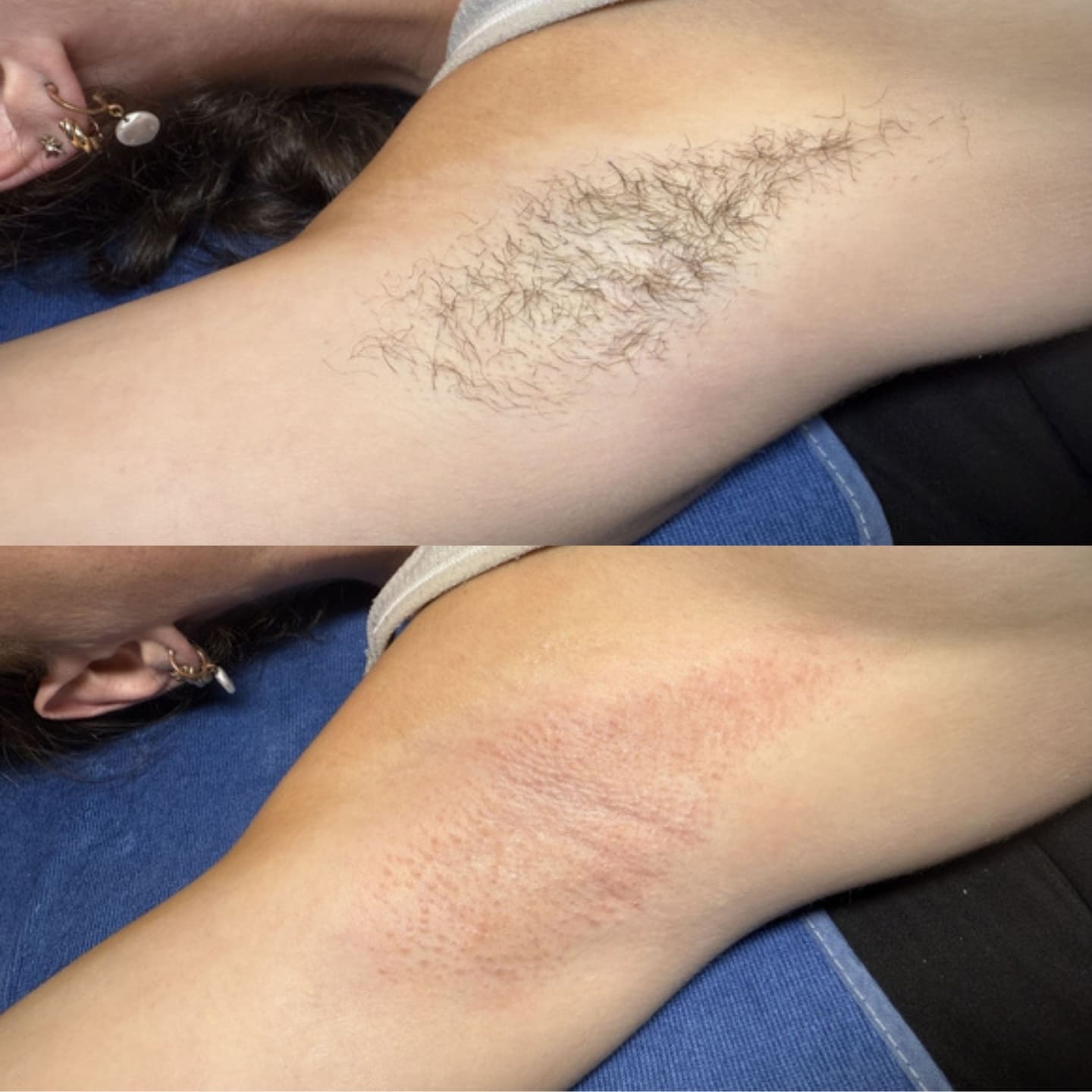 underarm-waxing-before-after (1)