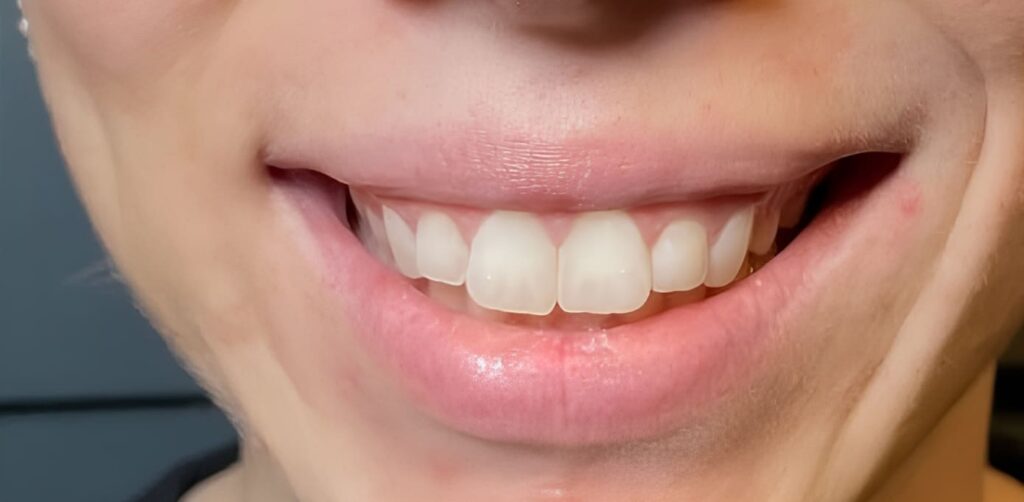 After